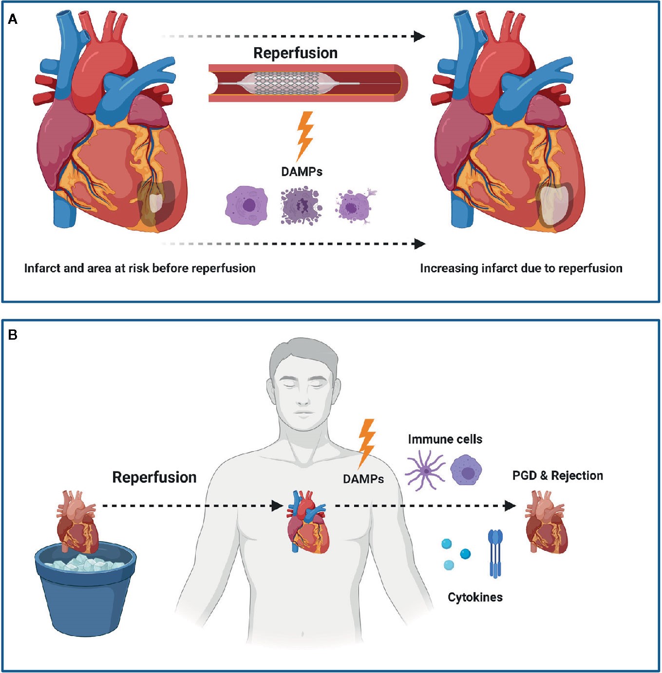Damage-Associated_Molecular_Patterns_in_Myocardial_Infarction_and_Heart_Transplantation_The_Road_to_Translational_Success